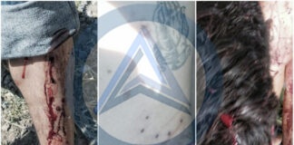 Deja Tres Heridos Agresión a Tiros en Xaloztoc - AlternativaTlx