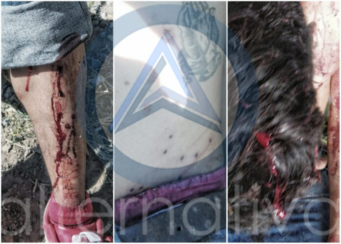 Deja Tres Heridos Agresión a Tiros en Xaloztoc - AlternativaTlx