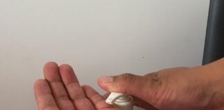 Identifica el Síndrome Guillain-Barré -AlternativaTlx