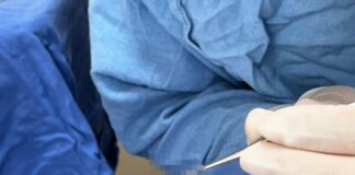 Realizó IMSS Tlaxcala Novena Procuración de Tejidos en el Hospital General de Zona No. 1 - AlternativaTlx